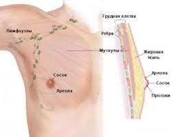 Рак груди у мужчин. Симптомы, диагностика и лечение